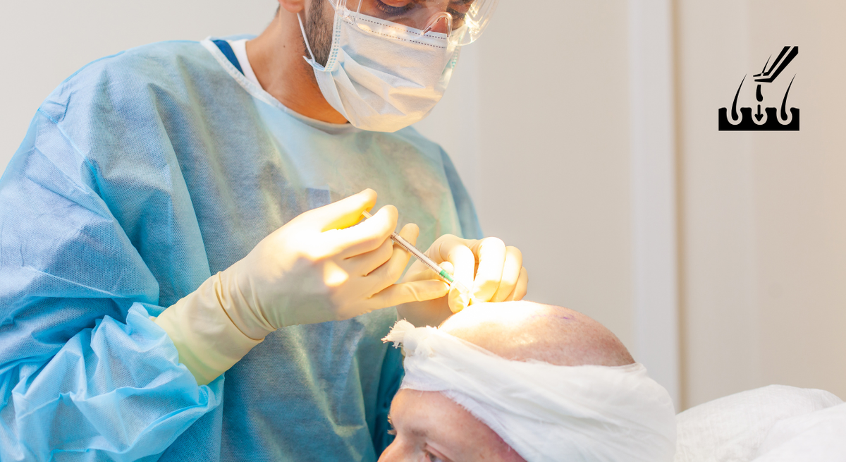 Follicular Unit Extraction (FUE)
