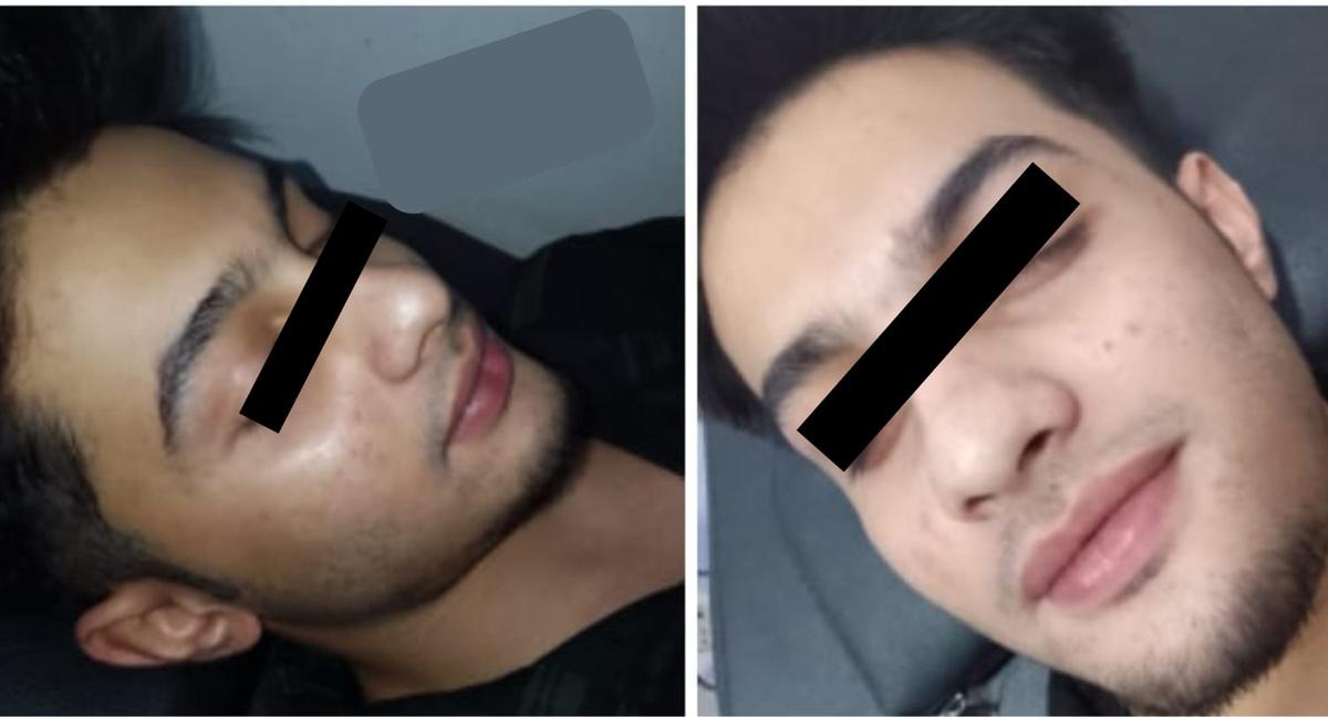 Glutathione Treatment