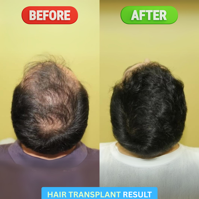 Transformation