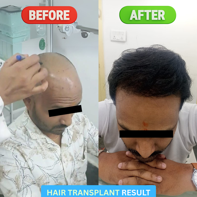 Transformation