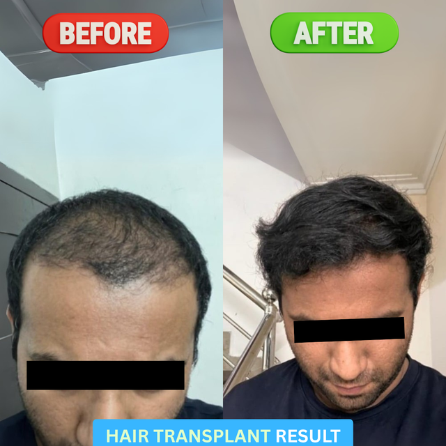Transformation