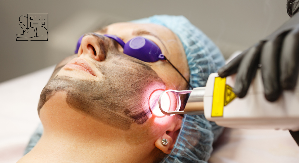 Laser Facial Rejuvenation