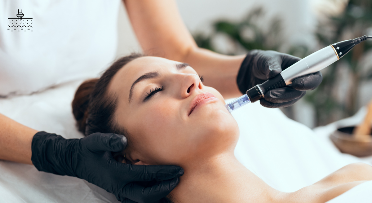 Microneedling
