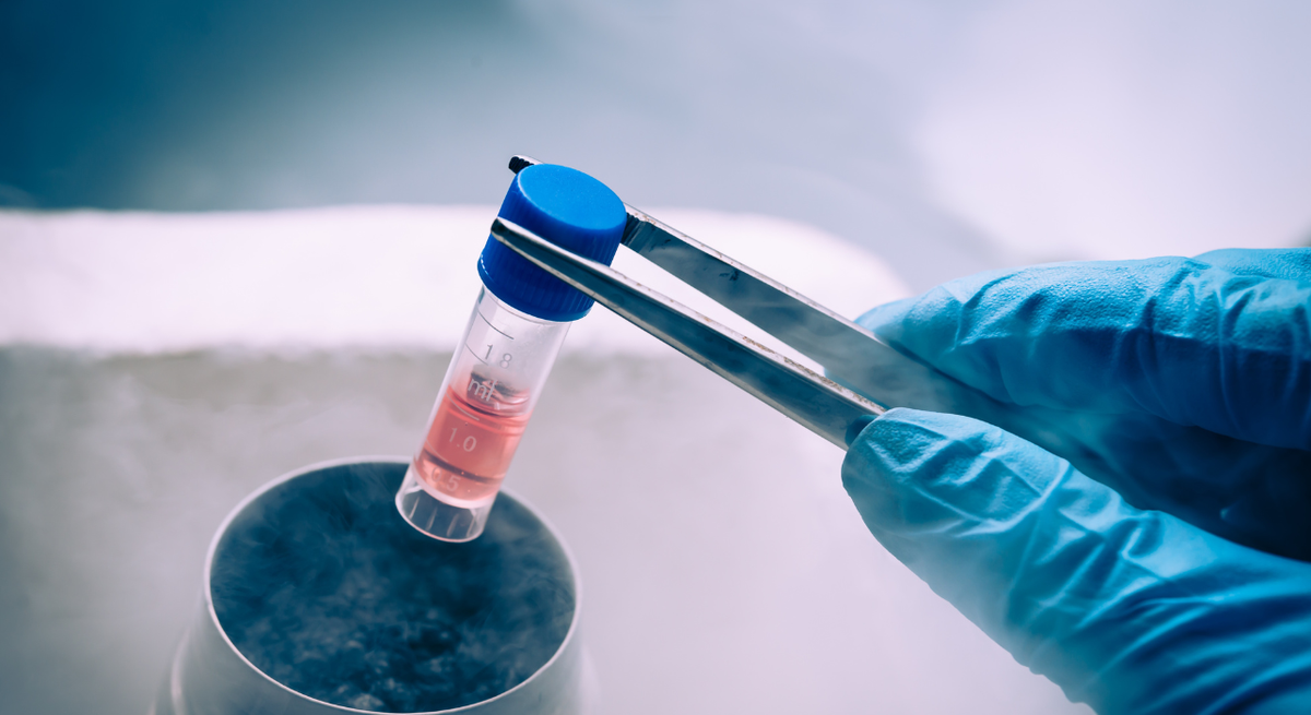 Stem Cell Hair Restoration