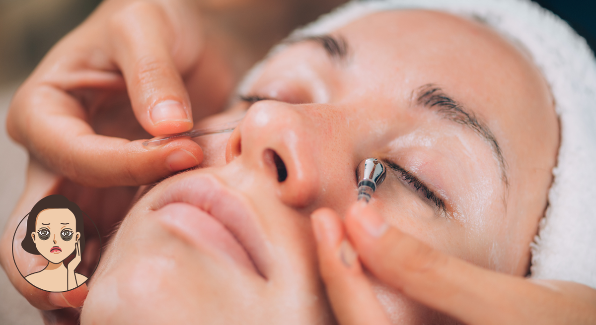 Under Eye Dark Circles Removal